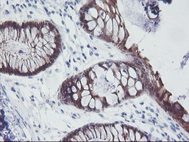IRF6 Antibody - IHC of paraffin-embedded Human colon tissue using anti-IRF6 mouse monoclonal antibody.