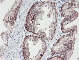 IRF6 Antibody - IHC of paraffin-embedded Human prostate tissue using anti-IRF6 mouse monoclonal antibody.