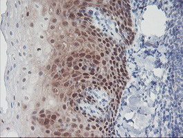 IRF6 Antibody - IHC of paraffin-embedded Human tonsil using anti-IRF6 mouse monoclonal antibody.