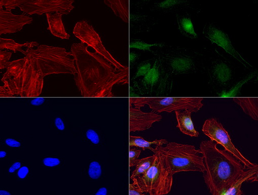 IRF6 Antibody - Immunofluorescent staining of HeLa cells using anti-IRF6 mouse monoclonal antibody  green, 1:100). Actin filaments were labeled with TRITC-phalloidin. (red), and nuclear with DAPI. (blue).