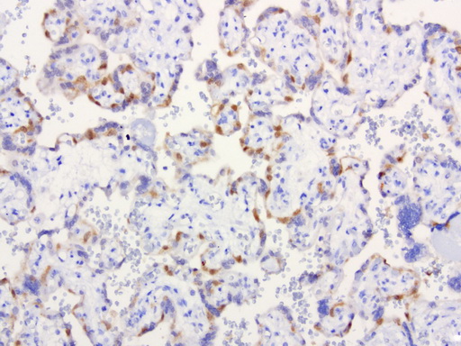 IRF6 Antibody - Immunohistochemical staining of paraffin-embedded human placenta using anti-IRF6 clone UMAB106 mouse monoclonal antibody at 1:200 with Polink2 Broad HRP DAB detection kit ; heat-induced epitope retrieval with citrate buffer, pH6.0at 95-100C. Strong nuclear staining is seen in placenta.
