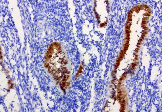 IRF6 Antibody - Immunohistochemical staining of paraffin-embedded human endometrium using anti-IRF6 clone UMAB106 mouse monoclonal antibody at 1:200 with Polink2 Broad HRP DAB detection kit ; heat-induced epitope retrieval with citrate buffer, pH6.0at 95-100C. Strong nuclear staining is seen in placenta.