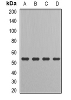 IRF6 Antibody - Western blot analysis of IRF-6 expression in HT29 (A); MCF7 (B); mouse kidney (C); rat liver (D) whole cell lysates.