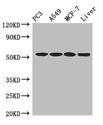 IRF6 Antibody - Positive WB detected in:PC3 whole cell lysate,A549 whole cell lysate,MCF-7 whole cell lysate,,Mouse liver tissue;All lanes:IRF6 antibody at 4?g/ml;Secondary;Goat polyclonal to rabbit IgG at 1/50000 dilution;Predicted band size: 54,42 KDa;Observed band size: 54 KDa;