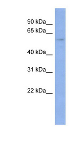 IRF7 Antibody - IRF7 antibody Western blot of HT1080 cell lysate. This image was taken for the unconjugated form of this product. Other forms have not been tested.