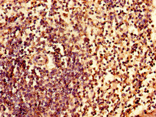 IRF7 Antibody - Immunohistochemistry of paraffin-embedded human spleen tissue using IRF7 Antibody at dilution of 1:100
