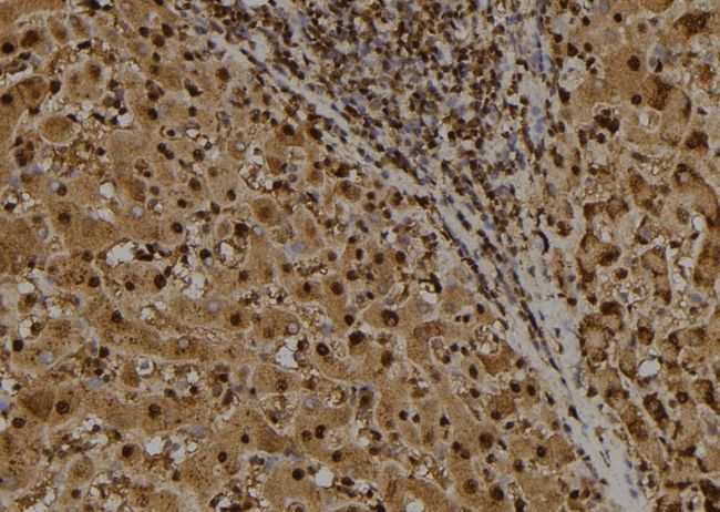 IRF7 Antibody - 1:100 staining human liver tissue by IHC-P. The sample was formaldehyde fixed and a heat mediated antigen retrieval step in citrate buffer was performed. The sample was then blocked and incubated with the antibody for 1.5 hours at 22°C. An HRP conjugated goat anti-rabbit antibody was used as the secondary.