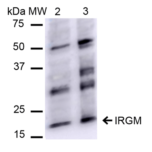 IRGM / LRG-47 Antibody - Western blot analysis of Human HeLa and HEK293Trap cell lysates showing detection of ~20.1 kDa IRGM protein using Rabbit Anti-IRGM Polyclonal Antibody. Lane 1: Molecular Weight Ladder (MW). Lane 2: HeLa cell lysates. Lane 3: 293Trap cell lysates. Load: 15 µg. Block: 5% Skim Milk in 1X TBST. Primary Antibody: Rabbit Anti-IRGM Polyclonal Antibody  at 1:1000 for 2 hours at RT. Secondary Antibody: Goat Anti-Rabbit IgG: HRP at 1:1000 for 60 min at RT. Color Development: ECL solution for 6 min in RT. Predicted/Observed Size: ~20.1 kDa.