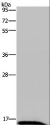 IRGM / LRG-47 Antibody - Western blot analysis of Human hepatocellular carcinoma tissue, using IRGM Polyclonal Antibody at dilution of 1:200.