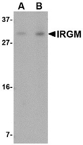 IRGM / LRG-47 Antibody - Western blot of IRGM in Rat brain lysate with IRGM antibody at (A) 1 and (B) 2 ug/ml.