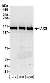 IRS Antibody - Detection of human IARS by western blot. Samples: Whole cell lysate (50 µg) from HeLa, HEK293T, and Jurkat cells prepared using NETN lysis buffer. Antibodies: Affinity purified rabbit anti-IARS antibody used for WB at 0.1 µg/ml. Detection: Chemiluminescence with an exposure time of 10 seconds.