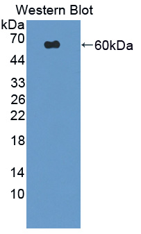 IRS Antibody - Western blot of IRS antibody.