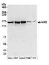 IRS Antibody - Detection of human and mouse IARS by western blot. Samples: Whole cell lysate (50 µg) from HeLa, HEK293T, Jurkat, mouse TCMK-1, and mouse NIH 3T3 cells prepared using NETN lysis buffer. Antibodies: Affinity purified rabbit anti-IARS antibody used for WB at 0.1 µg/ml. Detection: Chemiluminescence with an exposure time of 30 seconds.
