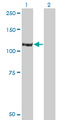 IRS Antibody - Western Blot analysis of IARS expression in transfected 293T cell line by IARS monoclonal antibody (M03), clone 3D3.Lane 1: IARS transfected lysate(120.6 KDa).Lane 2: Non-transfected lysate.