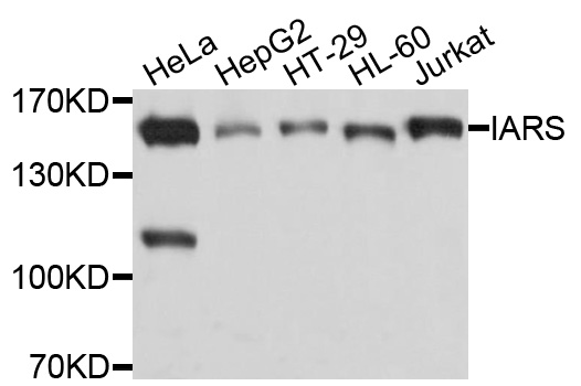 IRS Antibody - Western blot analysis of extracts of various cell lines, using IARS antibody at 1:1000 dilution. The secondary antibody used was an HRP Goat Anti-Rabbit IgG (H+L) at 1:10000 dilution. Lysates were loaded 25ug per lane and 3% nonfat dry milk in TBST was used for blocking. An ECL Kit was used for detection and the exposure time was 1s.