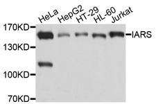 IRS Antibody - Western blot analysis of extracts of various cell lines, using IARS antibody at 1:1000 dilution. The secondary antibody used was an HRP Goat Anti-Rabbit IgG (H+L) at 1:10000 dilution. Lysates were loaded 25ug per lane and 3% nonfat dry milk in TBST was used for blocking. An ECL Kit was used for detection and the exposure time was 1s.