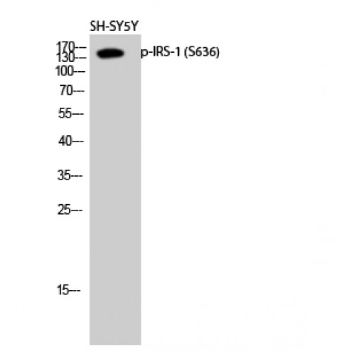 IRS1 Antibody - Western blot of Phospho-IRS-1 (S636) antibody