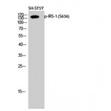 IRS1 Antibody - Western blot of Phospho-IRS-1 (S636) antibody