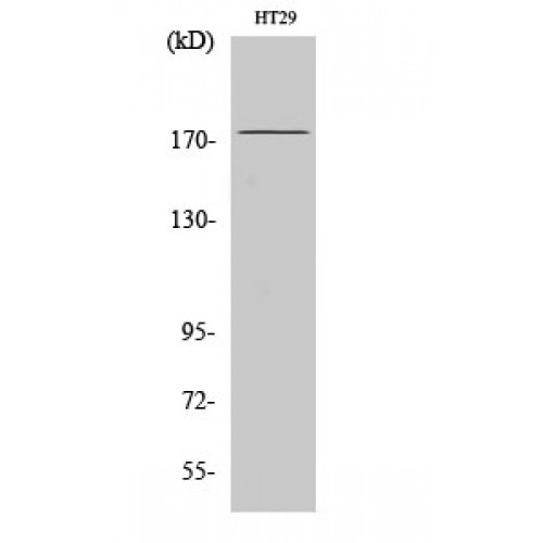 IRS1 Antibody - Western blot of IRS-1 antibody