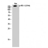 IRS1 Antibody - Western blot of Phospho-IRS-1 (S794) antibody