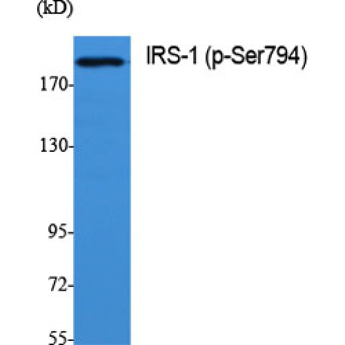 IRS1 Antibody - Western blot of Phospho-IRS-1 (S794) antibody