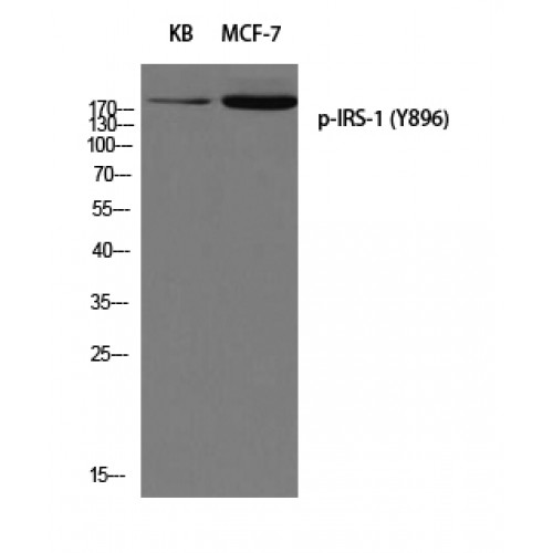 IRS1 Antibody - Western blot of Phospho-IRS-1 (Y896) antibody