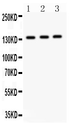 IRS1 Antibody - IRS1 antibody Western blot. All lanes: Anti IRS1 at 0.5 ug/ml. Lane 1: A549 Whole Cell Lysate at 40 ug. Lane 2: MM453 Whole Cell Lysate at 40 ug. Lane 3: JURKAT Whole Cell Lysate at 40 ug. Predicted band size: 132 kD. Observed band size: 132 kD.