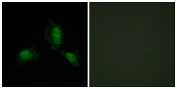 IRS1 Antibody - Immunofluorescence analysis of HeLa cells, using IRS-1 Antibody. The picture on the right is blocked with the synthesized peptide.