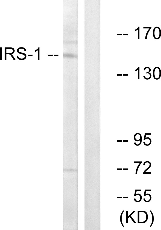 IRS1 Antibody - Western blot analysis of lysates from NIH/3T3 cells, using IRS-1 Antibody. The lane on the right is blocked with the synthesized peptide.