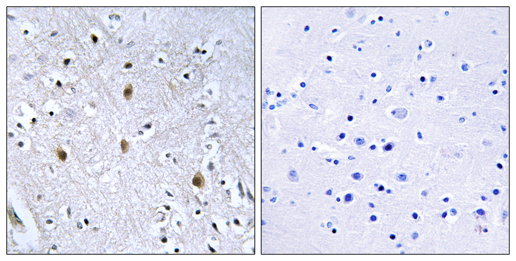 IRS1 Antibody - Immunohistochemistry analysis of paraffin-embedded human brain tissue, using IRS-1 Antibody. The picture on the right is blocked with the synthesized peptide.