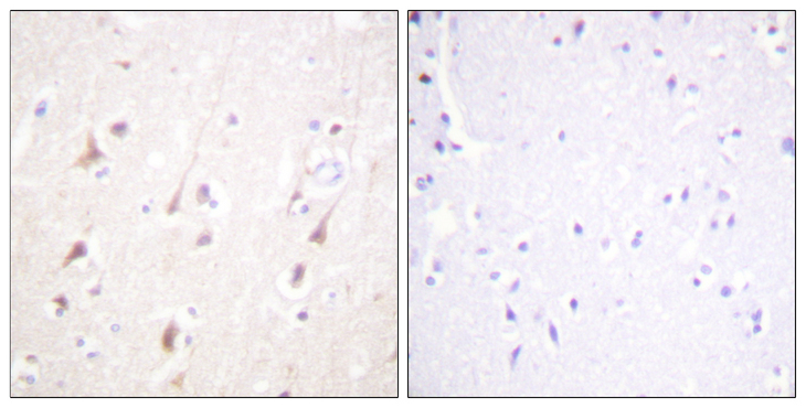 IRS1 Antibody - Immunohistochemistry analysis of paraffin-embedded human brain, using IRS-1 Antibody. The picture on the right is blocked with the synthesized peptide.
