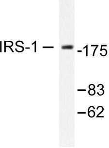IRS1 Antibody - Western blot of IRS-1 (R301) pAb in extracts from A431 or 293 cell treated with UV 30.