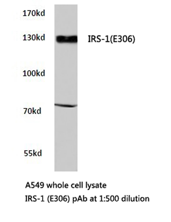 IRS1 Antibody - Western blot of IRS-1 (E306) pAb in extracts from A549 cells.