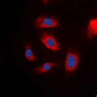 IRS1 Antibody - Immunofluorescent analysis of IRS1 staining in MCF7 cells. Formalin-fixed cells were permeabilized with 0.1% Triton X-100 in TBS for 5-10 minutes and blocked with 3% BSA-PBS for 30 minutes at room temperature. Cells were probed with the primary antibody in 3% BSA-PBS and incubated overnight at 4 deg C in a humidified chamber. Cells were washed with PBST and incubated with a DyLight 594-conjugated secondary antibody (red) in PBS at room temperature in the dark. DAPI was used to stain the cell nuclei (blue).