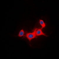 IRS1 Antibody - Immunofluorescent analysis of IRS1 staining in HeLa cells. Formalin-fixed cells were permeabilized with 0.1% Triton X-100 in TBS for 5-10 minutes and blocked with 3% BSA-PBS for 30 minutes at room temperature. Cells were probed with the primary antibody in 3% BSA-PBS and incubated overnight at 4 deg C in a humidified chamber. Cells were washed with PBST and incubated with a DyLight 594-conjugated secondary antibody (red) in PBS at room temperature in the dark. DAPI was used to stain the cell nuclei (blue).