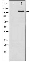 IRS1 Antibody - Western blot of IRS-1 expression in NIH-3T3 whole cell lysates,The lane on the left is treated with the antigen-specific peptide.