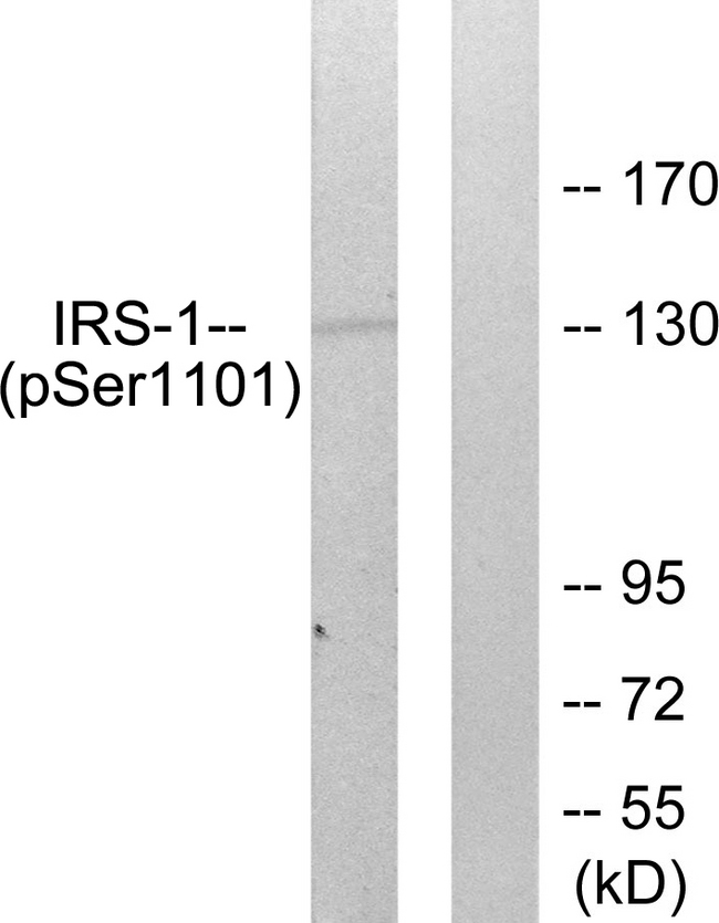 IRS1 Antibody - Western blot analysis of lysates from COS7 cells treated with Calyculin A 50ng/ml 30', using IRS-1 (Phospho-Ser1101) Antibody. The lane on the right is blocked with the phospho peptide.