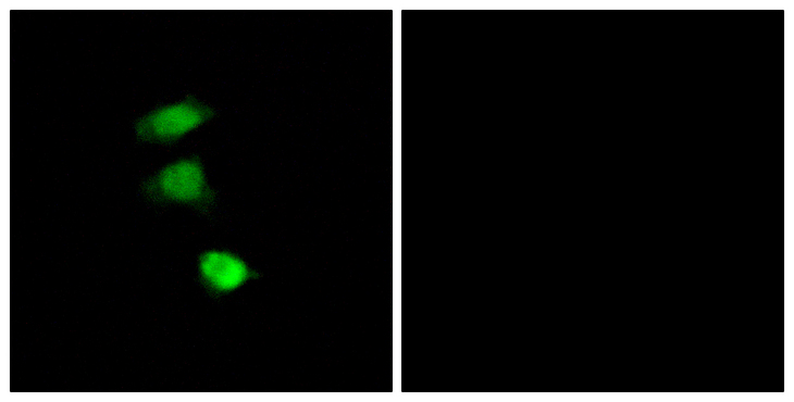 IRS1 Antibody - Immunofluorescence analysis of COS7 cells, using IRS-1 (Phospho-Ser307) Antibody. The picture on the right is blocked with the phospho peptide.
