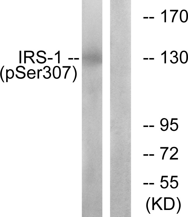 IRS1 Antibody - Western blot analysis of lysates from K562 cells, using IRS-1 (Phospho-Ser307) Antibody. The lane on the right is blocked with the phospho peptide.