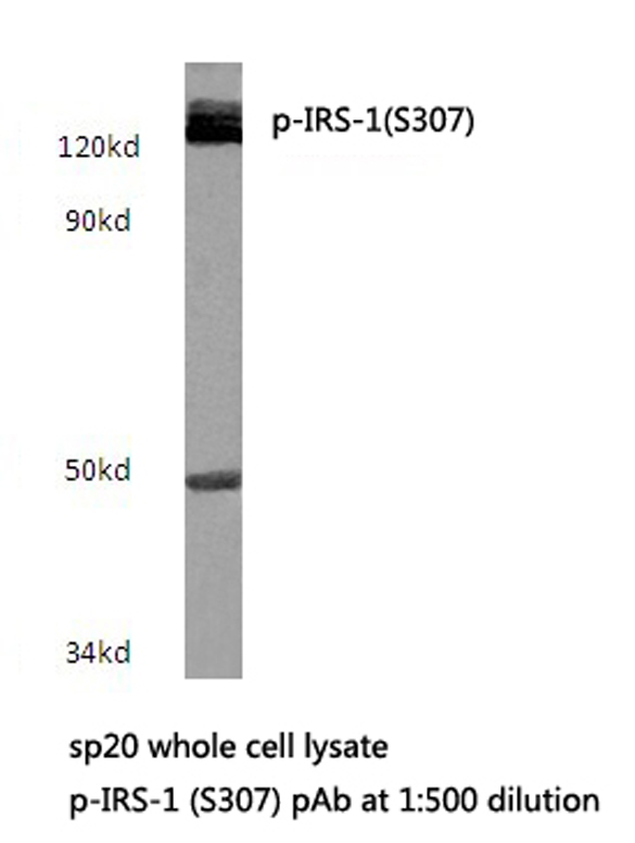 IRS1 Antibody - Western blot of p-IRS-1 (S307) pAb in extracts from sp20 cells.