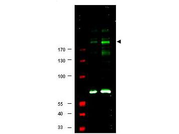 IRS1 Antibody - Anti-IRS1 pS307 Antibody - Western Blot. Western blot of Affinity Purified anti-IRS1 pS307 antibody shows detection of a band at ~180 kD believed to represent phosphorylated IRS1 (arrowhead). Lane 1 shows staining of human 293 cell lysate. Lane 2 shows staining of 293 cell lysate prepared from cells serum-starved for 18 h followed by treatment with 5 ug/ml of anisomysin for 30 min. The pronounced staining of the band at 180 kD is not seen when the antibody was pre-incubated with immunizing peptide prior to reaction (data not shown). The identity of the intensely reactive bands at ~70 kD in both lane 1 and 2 is unknown, although these bands were also competed out by pre-incubation with the immunizing peptide. Approximately 25 ug of each lysate was separated on a 4-20% Tris-Glycine gel by SDS-PAGE and transferred onto nitrocellulose. After blocking with 5% goat serum, 0.5% BLOTTO in PBS, the membrane was probed with the primary antibody diluted to 1:250. Reaction occurred overnight at 4C followed by washes and reaction with a 1:10000 dilution of IRDye800 conjugated Gt-a-Rabbit IgG [H&L] MX ( for 45 min at room temperature (800 nm channel, green). Molecular weight estimation was made by comparison to prestained MW markers in lane M (700 nm channel, red). IRDye800 fluorescence image was captured using the Odyssey Infrared Imaging System developed by LI-COR. IRDye is a trademark of LI-COR, Inc. Other detection systems will yield similar results.