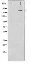 IRS1 Antibody - Western blot of IRS-1 phosphorylation expression in K562 whole cell lysates,The lane on the left is treated with the antigen-specific peptide.