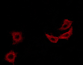 IRS1 Antibody - Staining MCF-7 cells by IF/ICC. The samples were fixed with PFA and permeabilized in 0.1% saponin prior to blocking in 10% serum for 45 min at 37°C. The primary antibody was diluted 1/400 and incubated with the sample for 1 hour at 37°C. A Alexa Fluor 594 conjugated goat polyclonal to rabbit IgG (H+L), diluted 1/600 was used as secondary antibody.