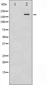 IRS1 Antibody - Western blot analysis of IRS-1 phosphorylation expression in K562 whole cells lysates. The lane on the left is treated with the antigen-specific peptide.
