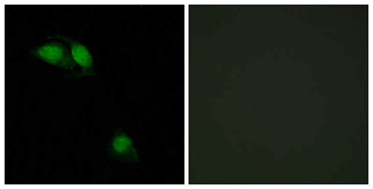 IRS1 Antibody - Immunofluorescence analysis of HeLa cells, using IRS-1 (Phospho-Ser312) Antibody. The picture on the right is blocked with the phospho peptide.