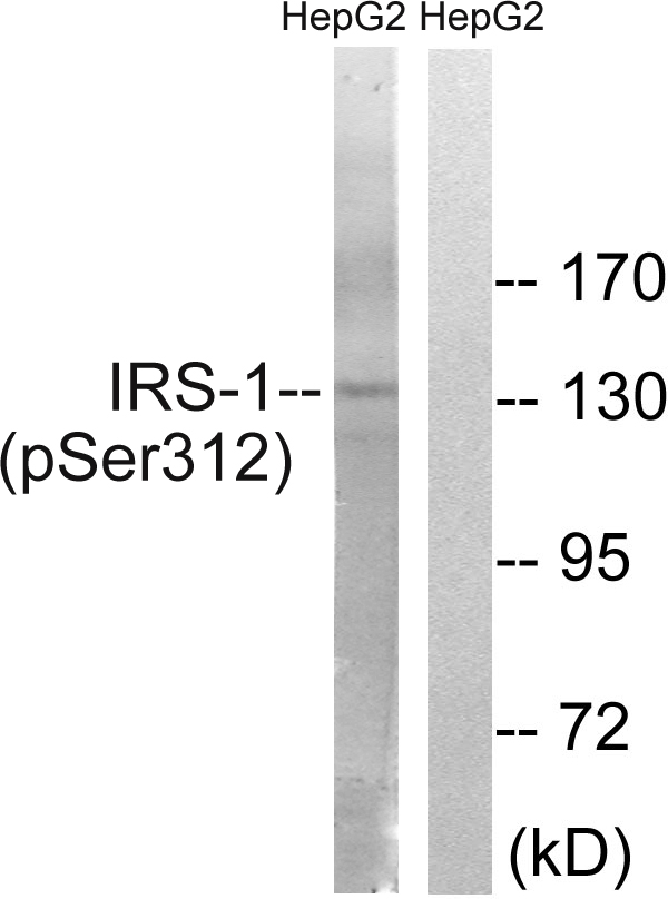 IRS1 Antibody - Western blot analysis of lysates from HepG2 cells, using IRS-1 (Phospho-Ser312) Antibody. The lane on the right is blocked with the phospho peptide.