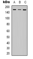 IRS1 Antibody - Western blot analysis of IRS1 (pS312) expression in HepG2 (A); HeLa (B); mouse spleen (C) whole cell lysates.