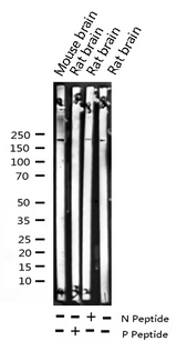 IRS1 Antibody - Western blot analysis of Phospho-IRS-1 (Ser312) expression in various lysates