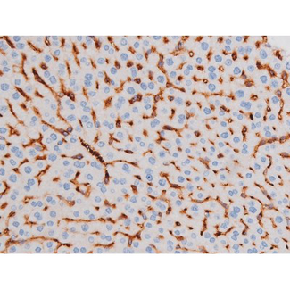 IRS1 Antibody - 1:200 staining mouse liver tissue by IHC-P. The tissue was formaldehyde fixed and a heat mediated antigen retrieval step in citrate buffer was performed. The tissue was then blocked and incubated with the antibody for 1.5 hours at 22°C. An HRP conjugated goat anti-rabbit antibody was used as the secondary.