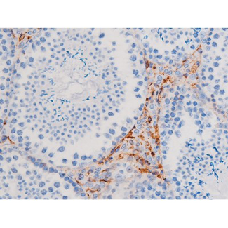IRS1 Antibody - 1:200 staining mouse testis tissue by IHC-P. The tissue was formaldehyde fixed and a heat mediated antigen retrieval step in citrate buffer was performed. The tissue was then blocked and incubated with the antibody for 1.5 hours at 22°C. An HRP conjugated goat anti-rabbit antibody was used as the secondary.